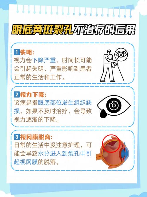 眼睛出现这5种变化或预示疾病风险,建议赶紧收藏