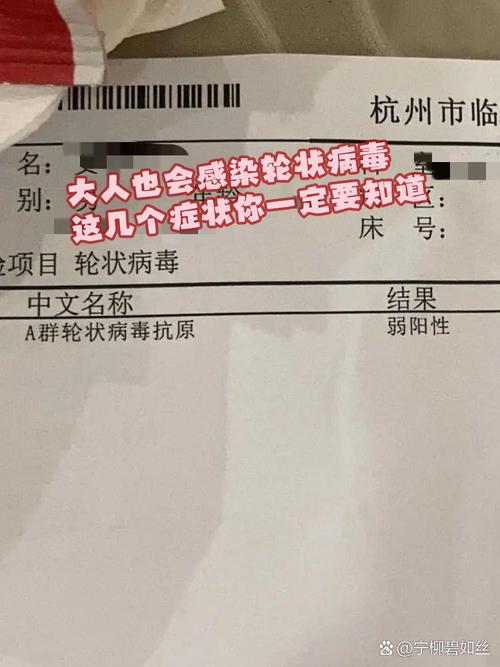 埃博拉病毒最新消息：瑞德西韦作用、宁波疫情防控寻人通告